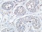 VEGF-D Polyclonal Antibody